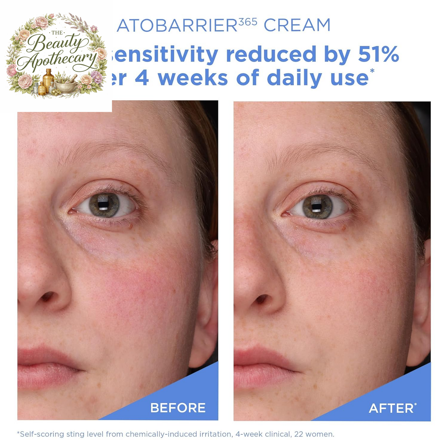 ATOBARRIER365 Cream with Ceramides, Korean Face Moisturizer for Barrier Repair | 120H Lasting Hydration, Ceramide Capsules, Dry & Sensitive Skin, Non-Comedogenic, 80 Ml / 2.70 Fl.Oz.