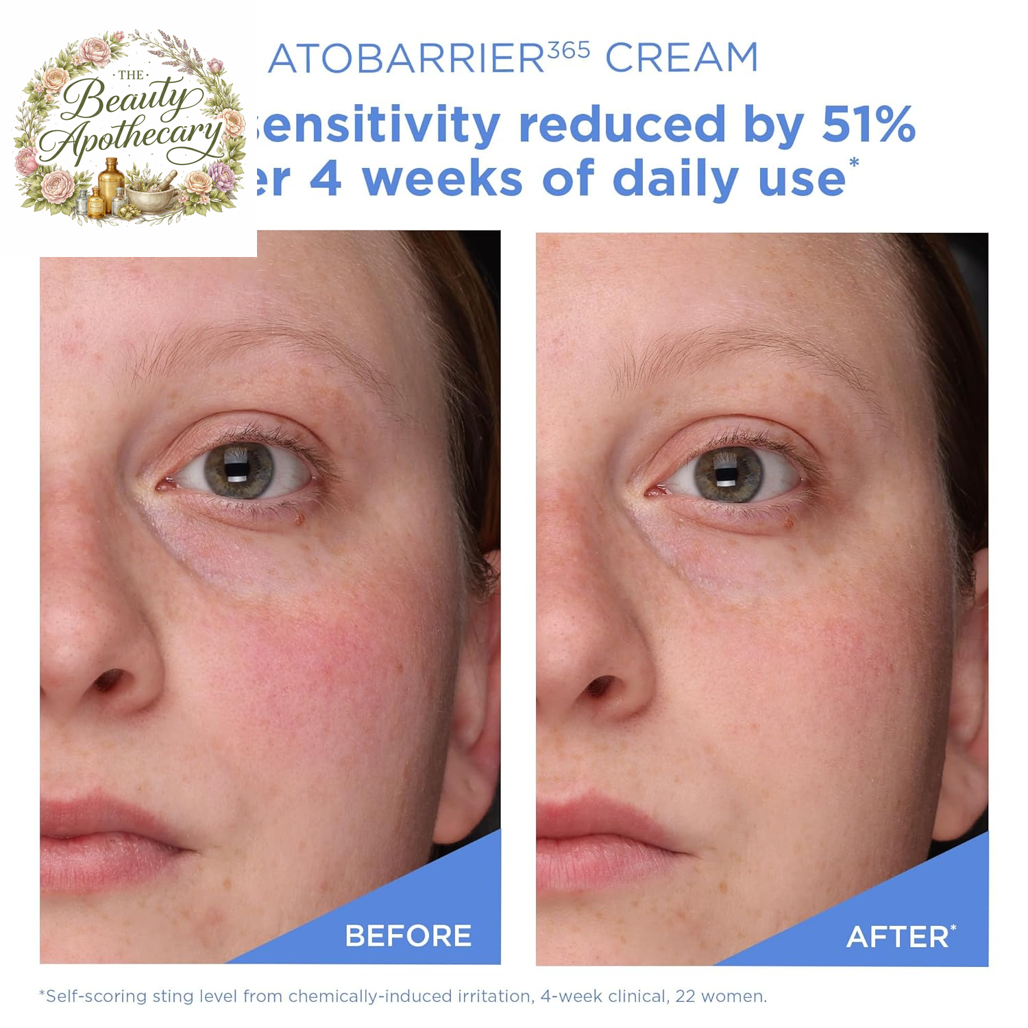 ATOBARRIER365 Cream with Ceramides, Korean Face Moisturizer for Barrier Repair | 120H Lasting Hydration, Ceramide Capsules, Dry & Sensitive Skin, Non-Comedogenic, 80 Ml / 2.70 Fl.Oz.